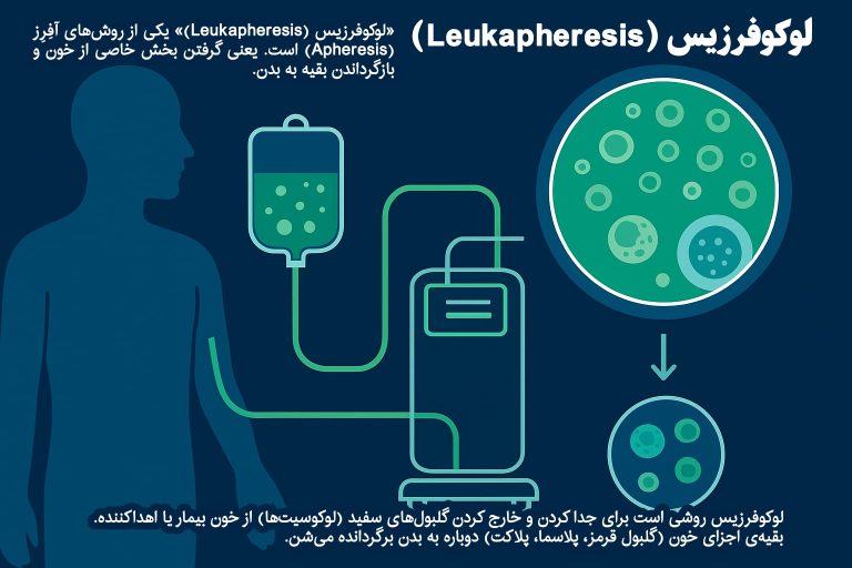 لوکوفرزیس روشی است برای جدا کردن و خارج کردن گلبول‌های سفید (لوکوسیت‌ها) از خون بیمار یا اهداکننده.