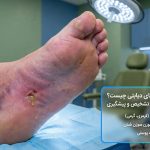 علائم زخم دیابتی پا - زخم قانقاریا - مرض قند